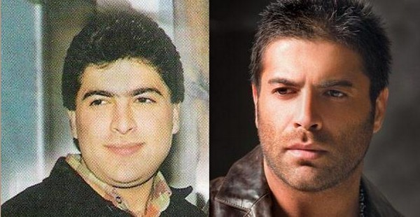 Arab Celebrities Before After